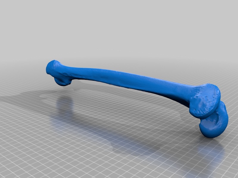 右股骨3D打印模型