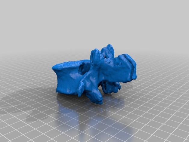 三维扫描椎骨3D打印模型