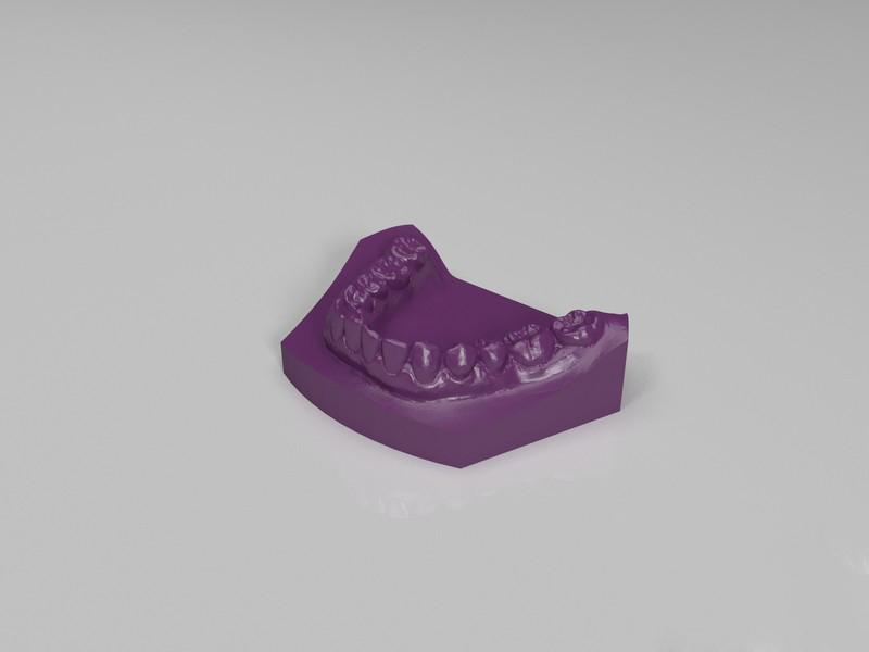 标准牙模3D打印模型