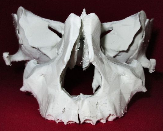 生物骨架3D打印模型