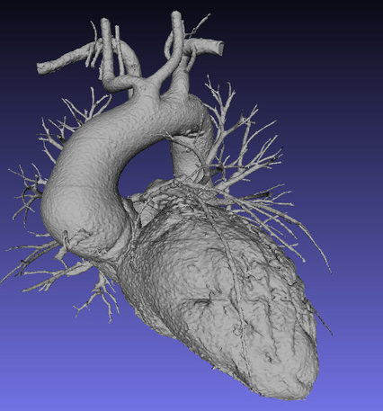 3D打印心脏3D打印模型