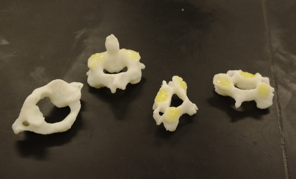 人类颈椎3D打印模型