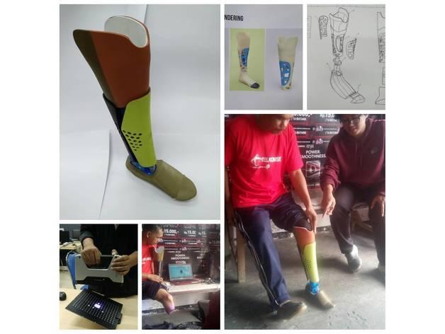 假肢-腿3D打印模型
