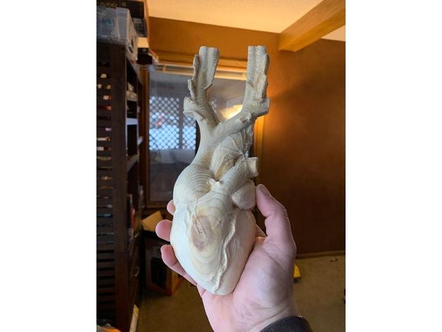 医学用心脏模型3D打印模型