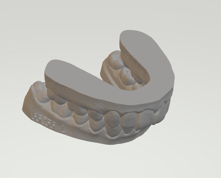 上下牙模型3D打印模型