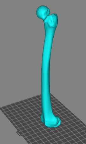 人的左腿股骨3D打印模型