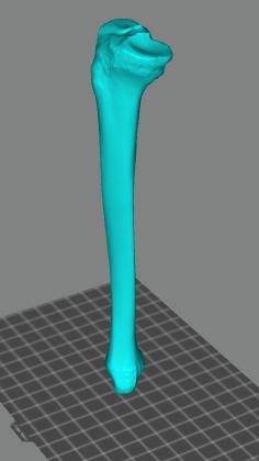 人的右腿胫骨3D打印模型