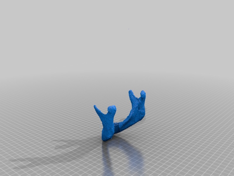 下颚骨医学模型3D打印模型