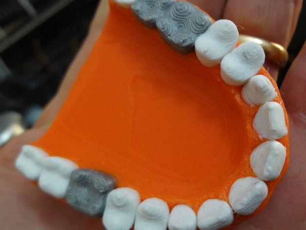 牙齿修复3D打印模型