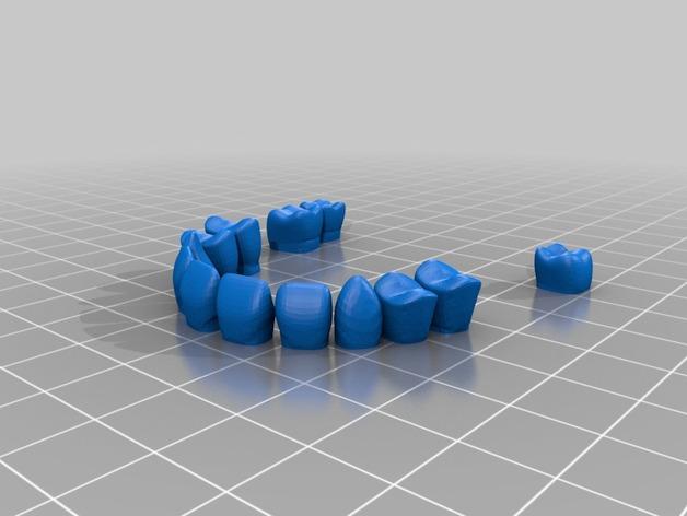 牙齿修复3D打印模型
