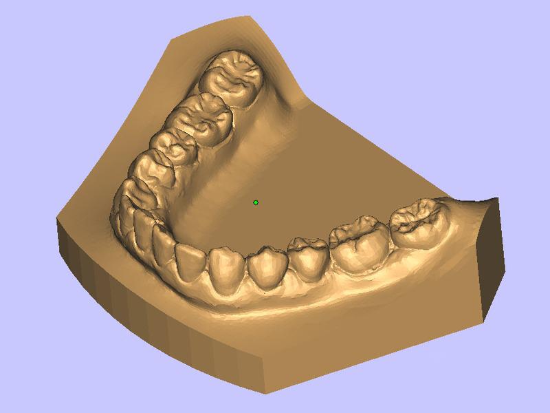 标准牙模3D打印模型