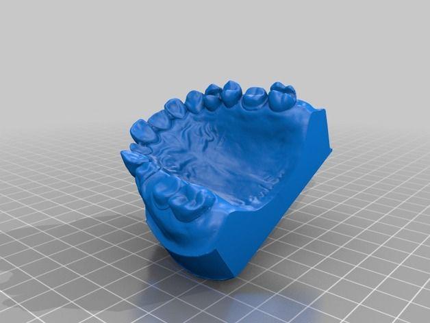 人类齿颚模型3D打印模型