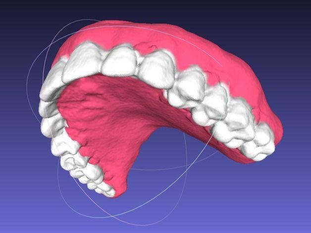 人类牙齿结构模型3D打印模型