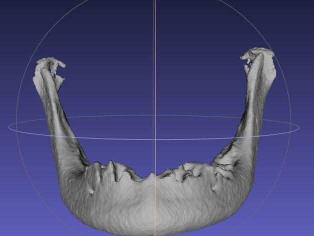 3D打印生物医学模型 人类颌骨模型3D打印模型