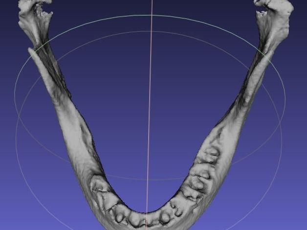 3D打印生物医学模型 人类颌骨模型3D打印模型