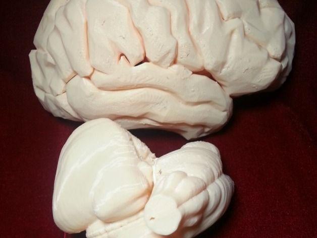 3D打印生物医学模型  小脑和脑干3D打印模型