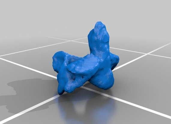 宫颈颈椎3D打印模型