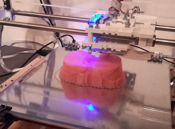 肺3D打印模型