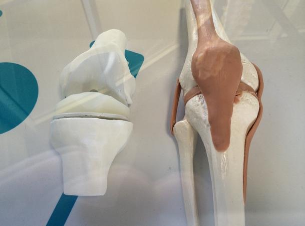 膝关节模型3D打印模型