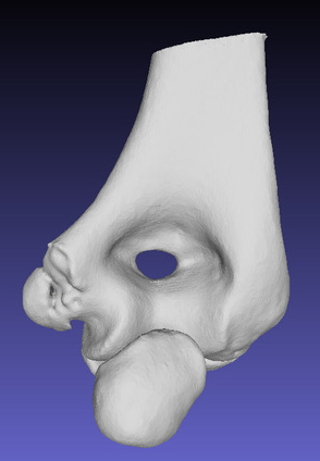 骨关节模型3D打印模型