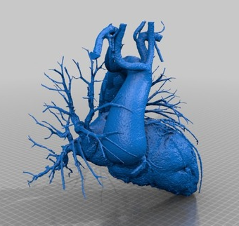 3D打印心脏3D打印模型