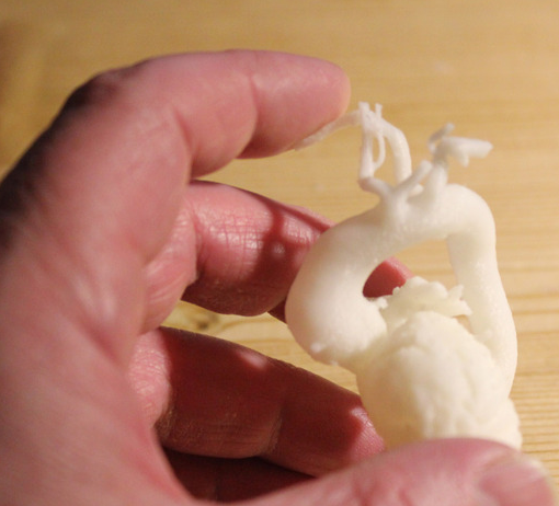 3D打印心脏3D打印模型