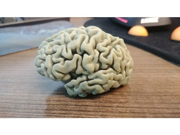 人脑3D打印模型