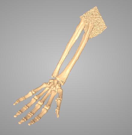 手骨3D打印模型