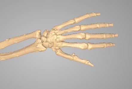 手骨3D打印模型