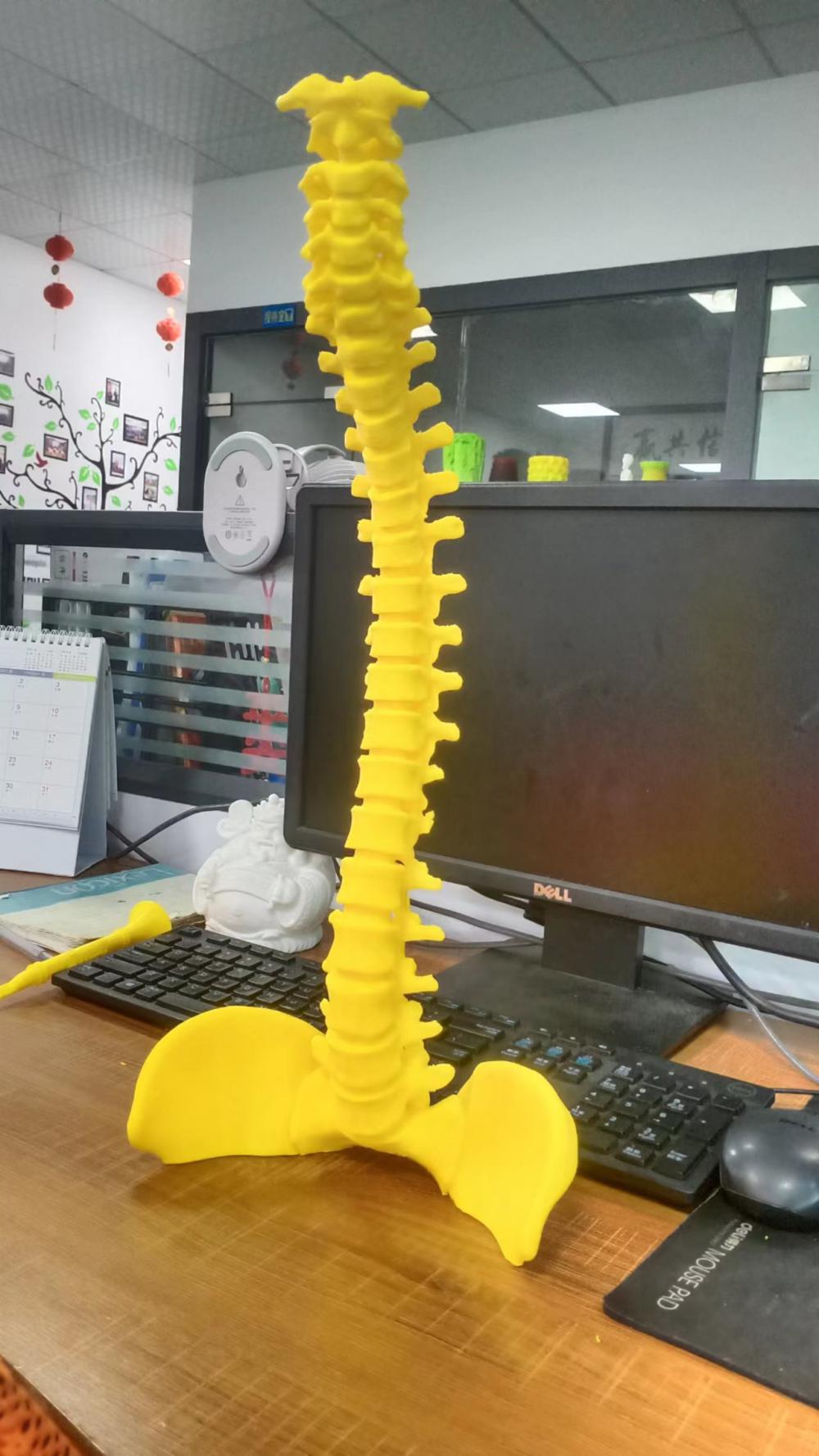 拼装脊椎3D打印模型