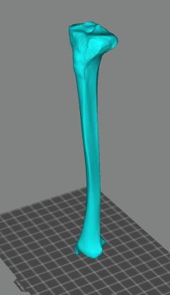 人的左腿胫骨3D打印模型
