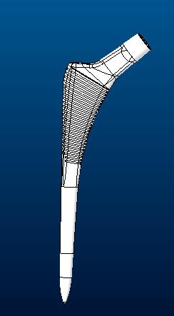 髋关节假体股骨柄sumit3D打印模型