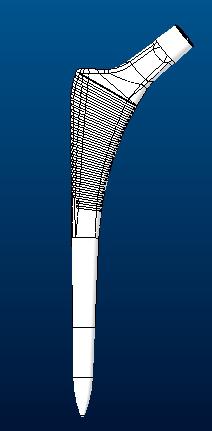 髋关节假体股骨柄sumit3D打印模型