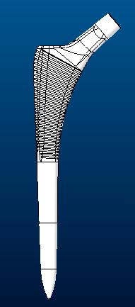 髋关节假体股骨柄sumit3D打印模型