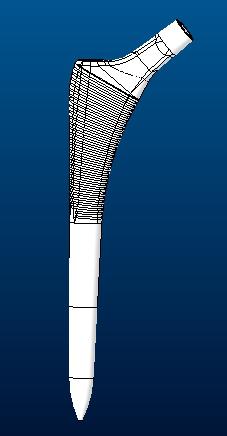 髋关节假体股骨柄sumit3D打印模型