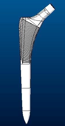 髋关节假体股骨柄sumit3D打印模型