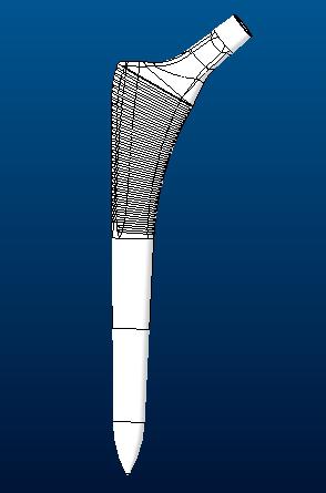 髋关节假体股骨柄sumit3D打印模型