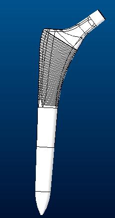 髋关节假体股骨柄sumit3D打印模型